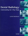 Understanding x-rays